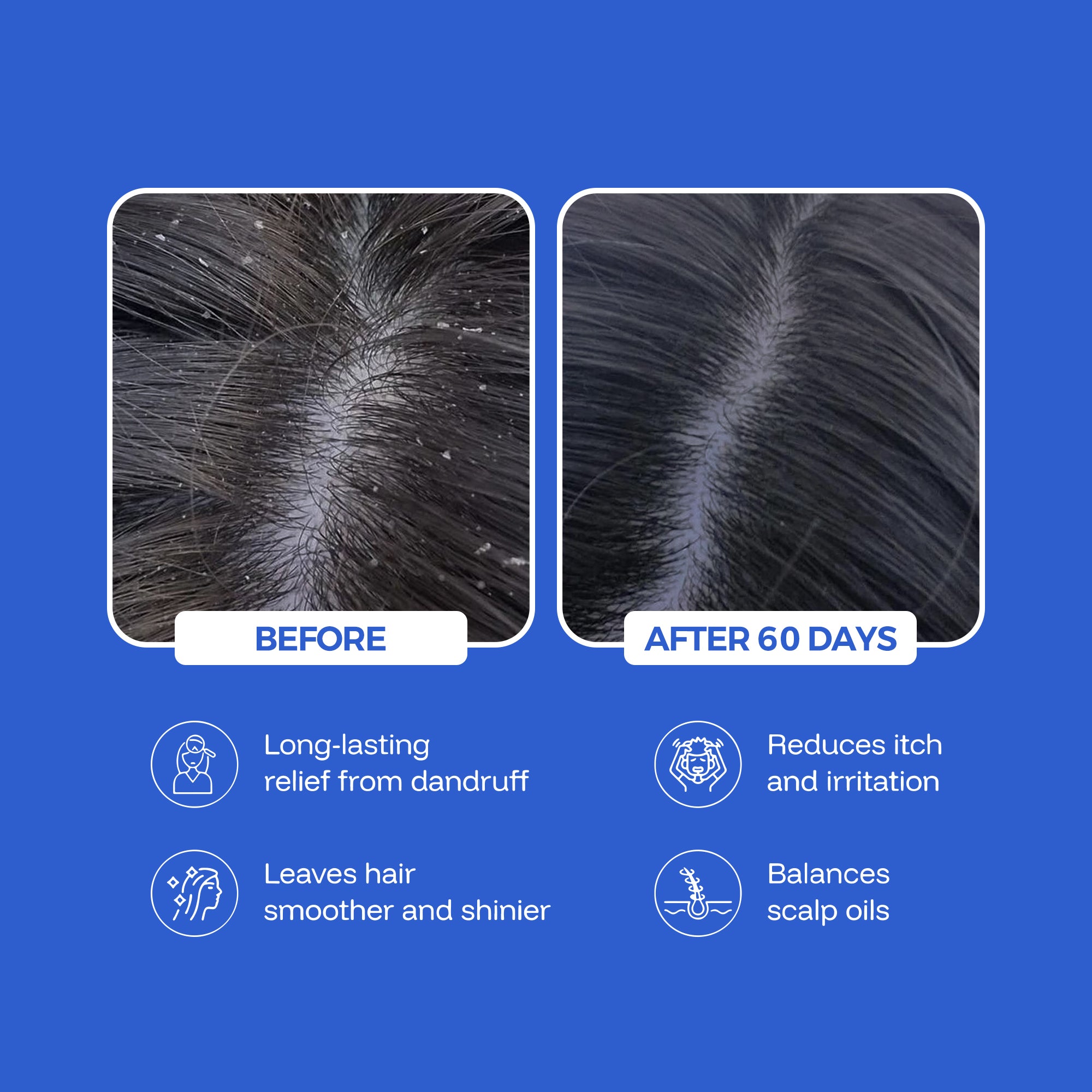 ANTI DANDRUFF HAIR OIL